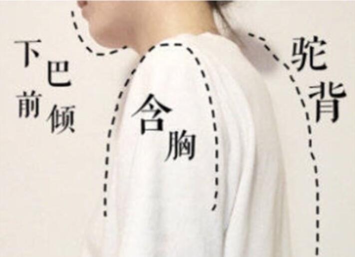 南寧美容學(xué)校：堅持一個月，駝背變直背