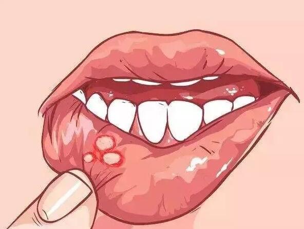身體發(fā)出信號(hào)，你該補(bǔ)維生素了