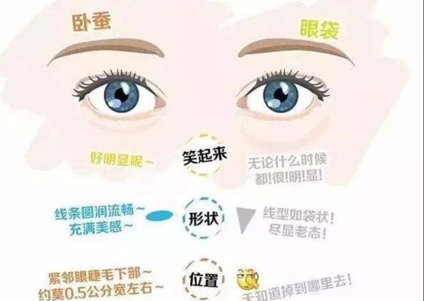 眼袋還是臥蠶，快來(lái)學(xué)辨別的方法