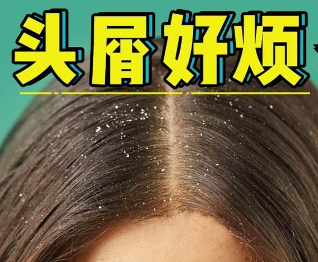 南寧正規(guī)美發(fā)培訓學校分享：冬天如何減少頭屑過多？