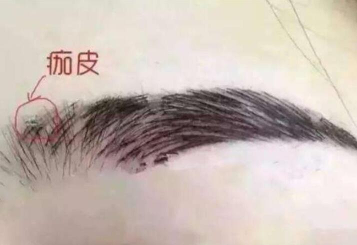 紋眉結(jié)痂時要注意什么？麗紋竹繡學(xué)校教你