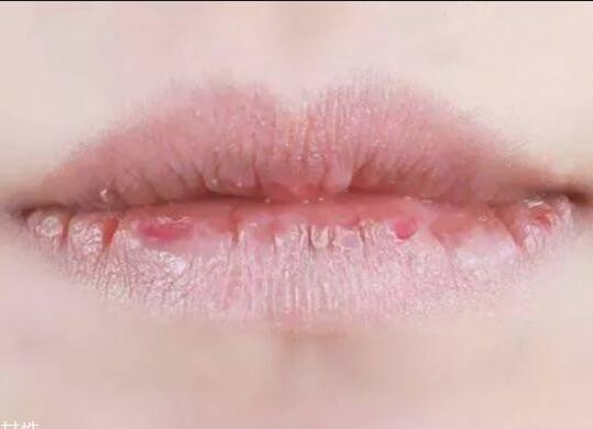 紋唇后嘴巴干燥怎么辦？南寧教紋繡的學(xué)校幫你解決