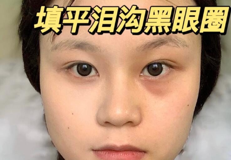 填平淚溝黑眼圈教程，廣西南寧化妝學(xué)校分享