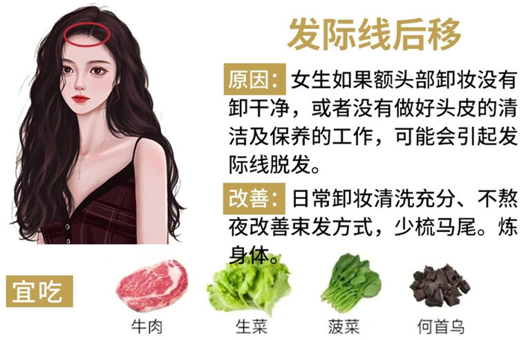 如何改善掉頭發(fā)？南寧頭療養(yǎng)發(fā)護(hù)發(fā)教學(xué)